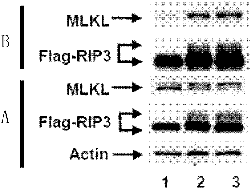 MLKL protein and application of MLKL protein as target point of cell necrosis inhibitor