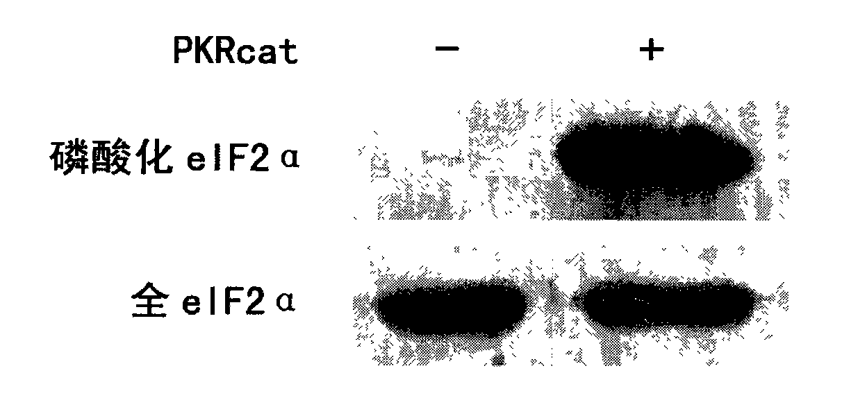 Polypeptide combinative with PKR kinase structure field specificity and uses thereof