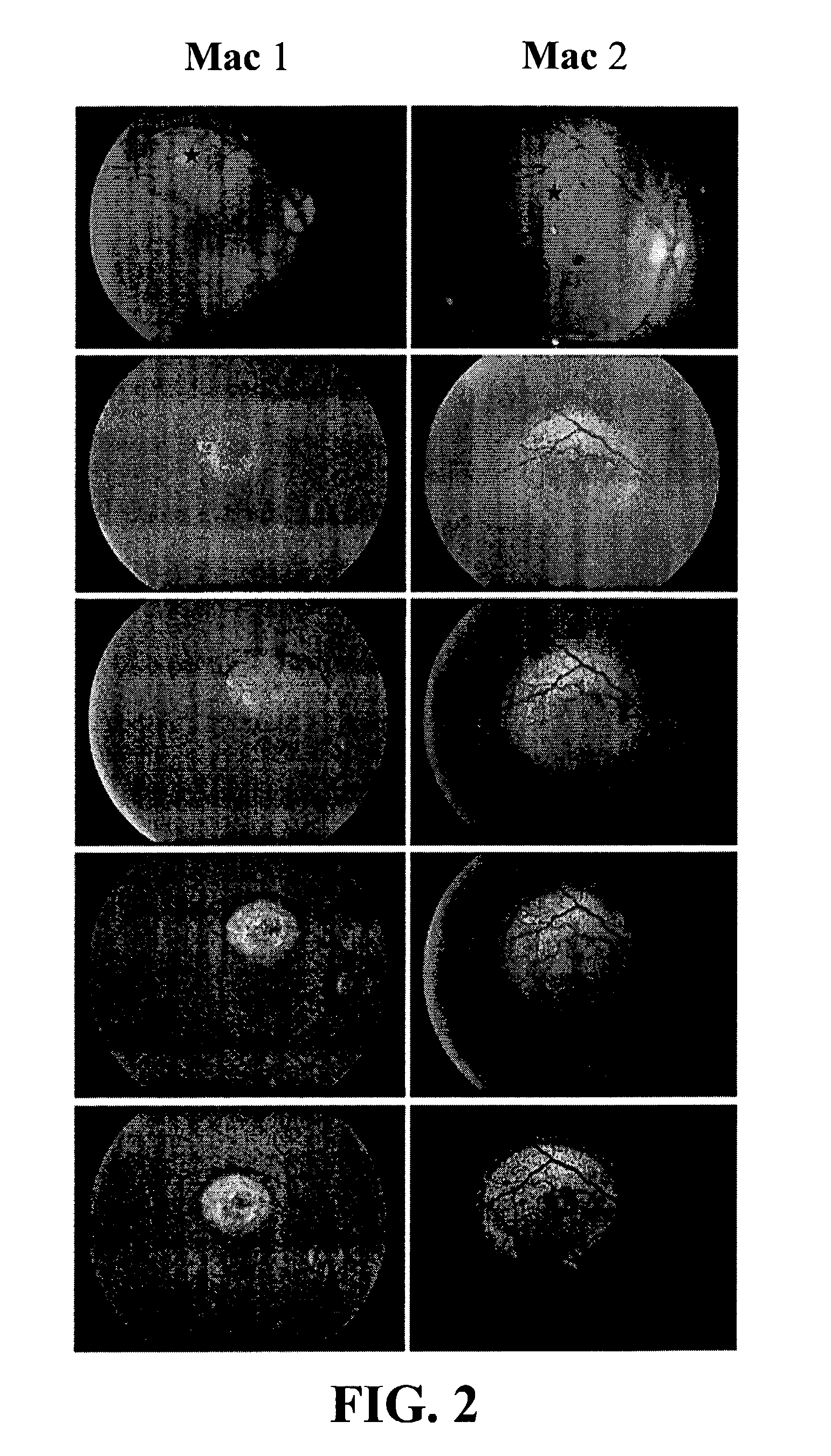 Method and vectors for selectively transducing retinal pigment epithelium cells