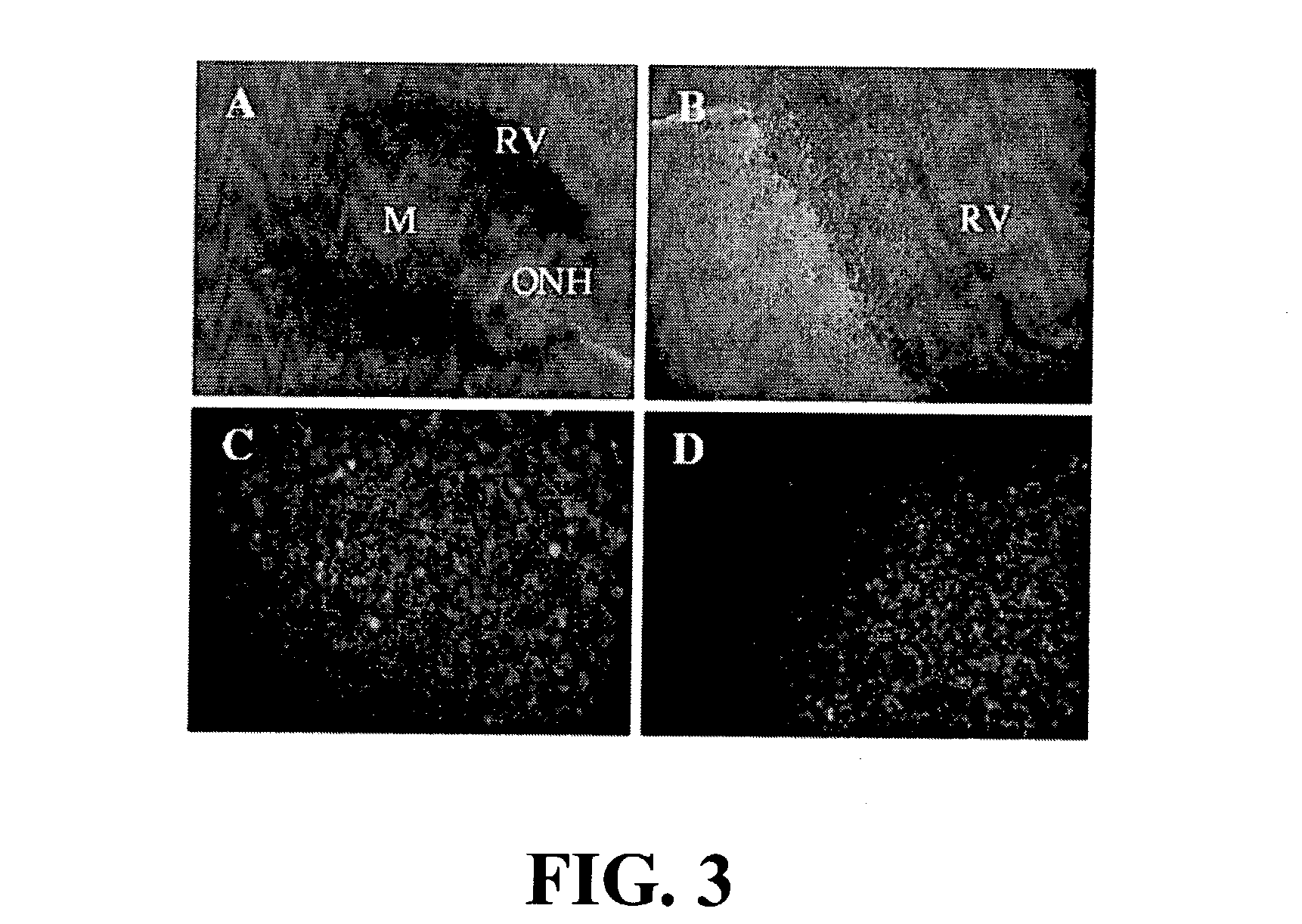 Method and vectors for selectively transducing retinal pigment epithelium cells