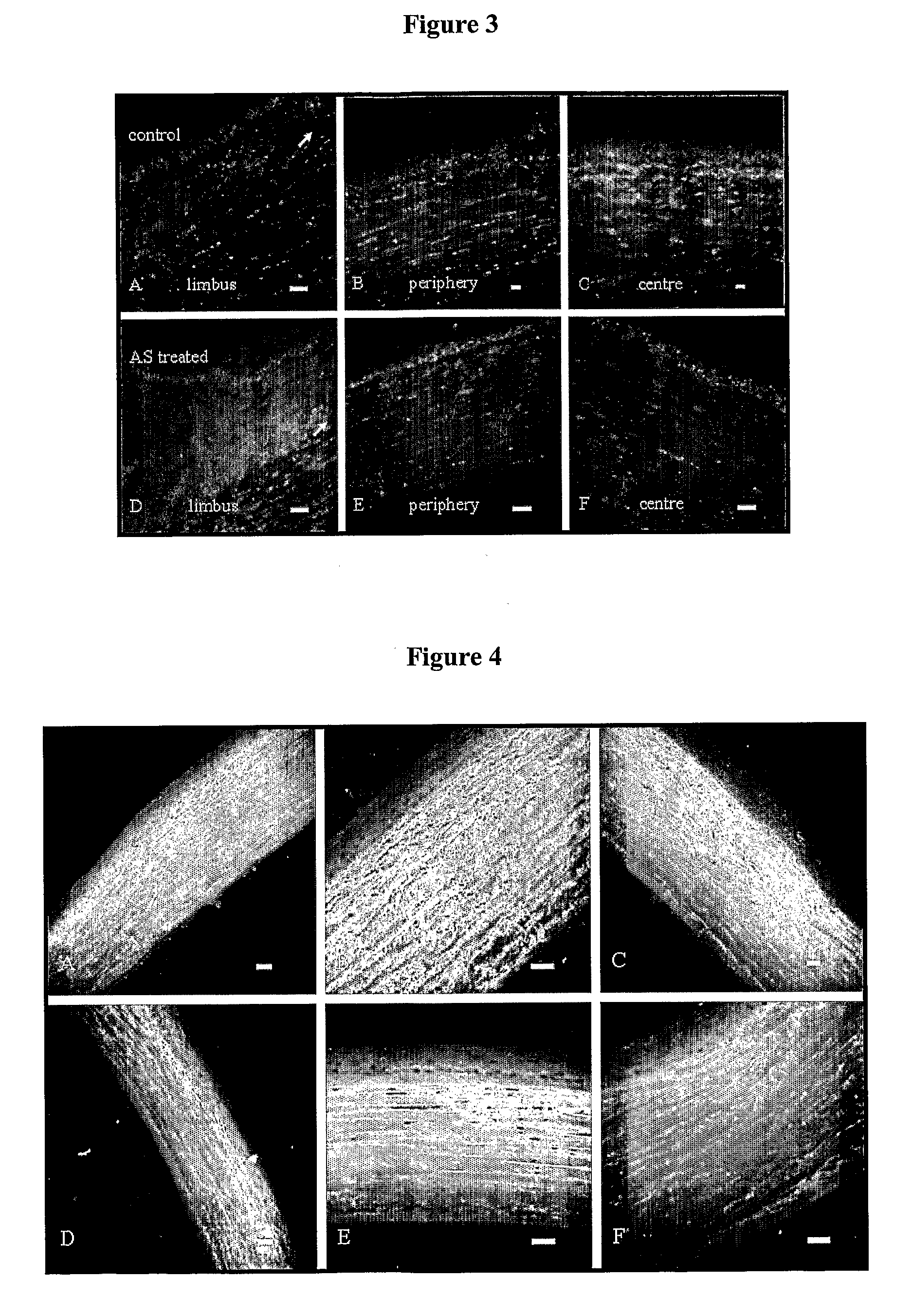 Antisense Compounds Targeted to Connexins and Methods of Use Thereof