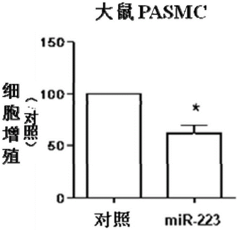 Application of small-molecule RNA and Rho kinase inhibitor