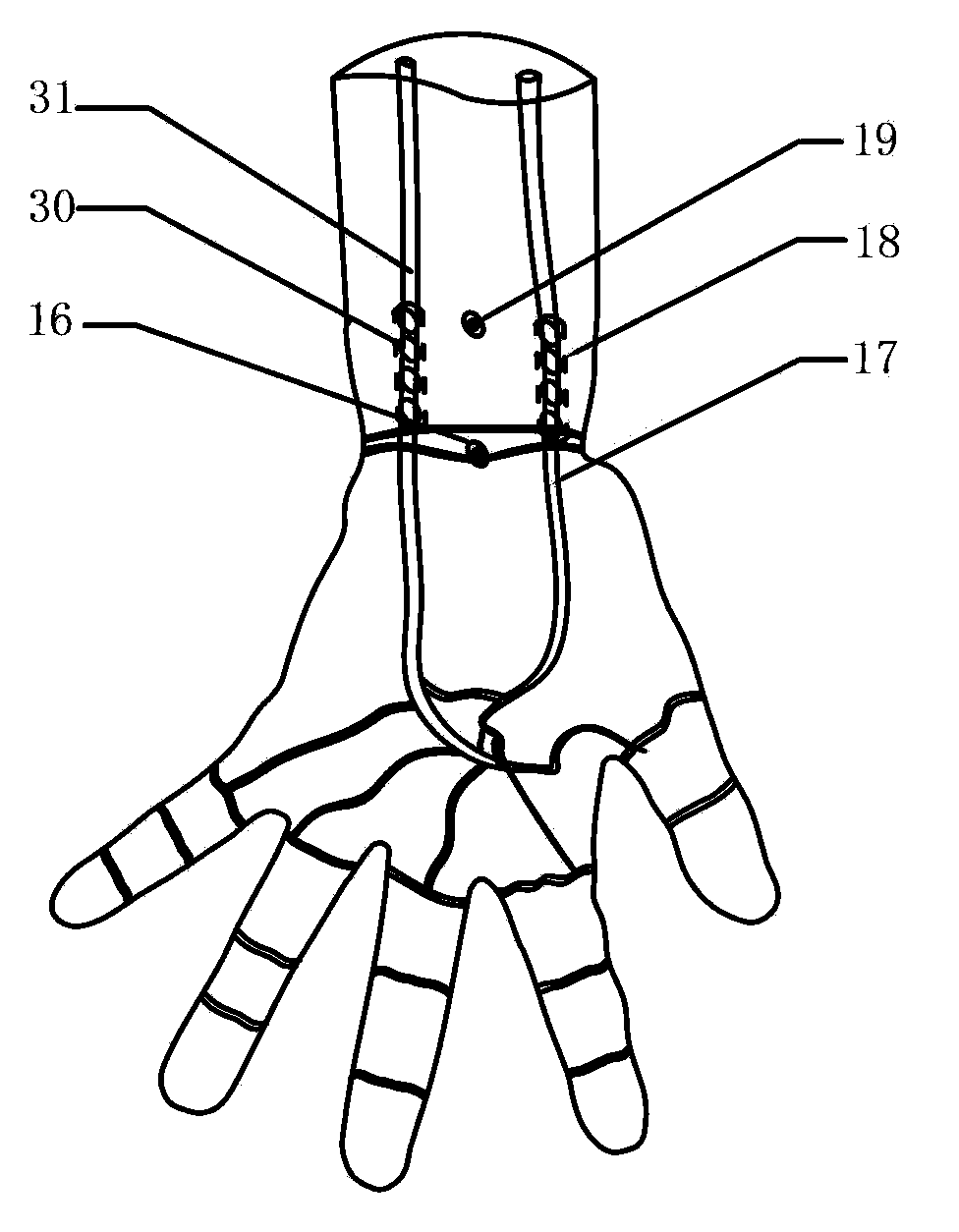 Laser therapeutic instrument with ulnar artery irradiation function