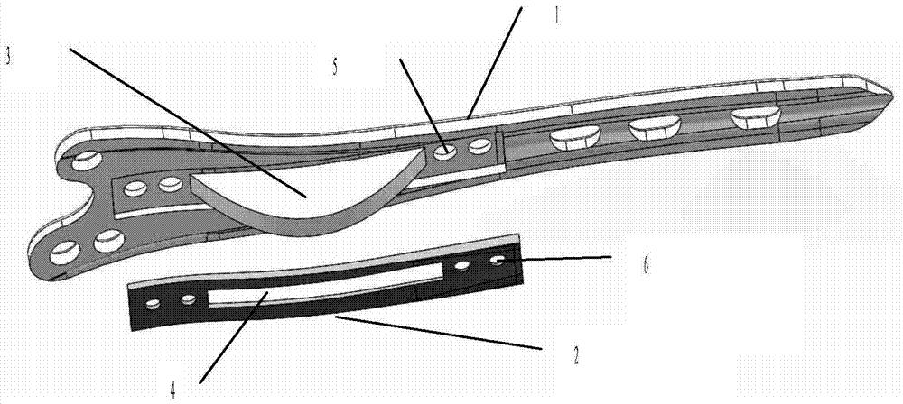 A bone plate device for distal femur fracture