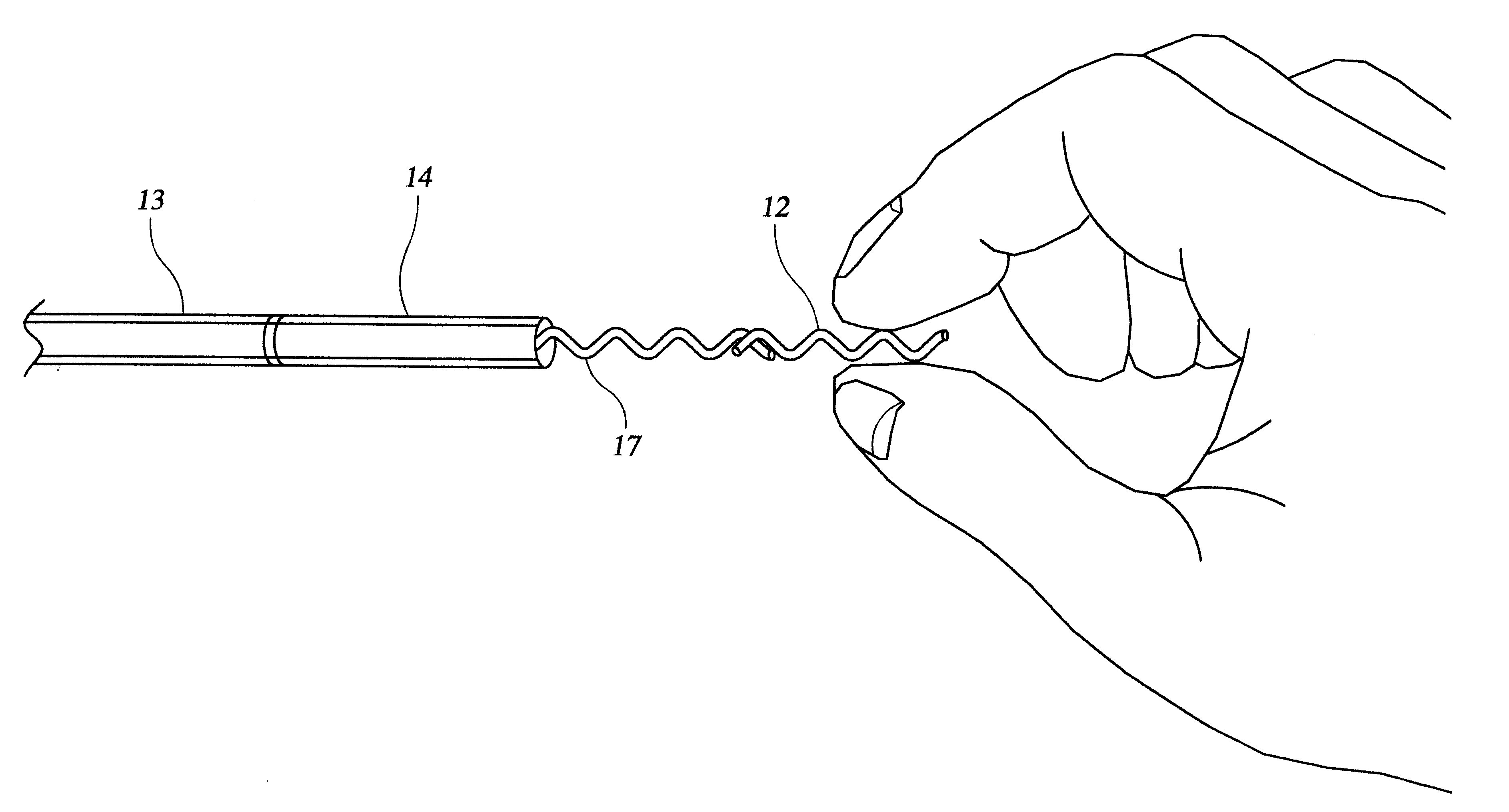 Implant delivery catheter system and methods for its use