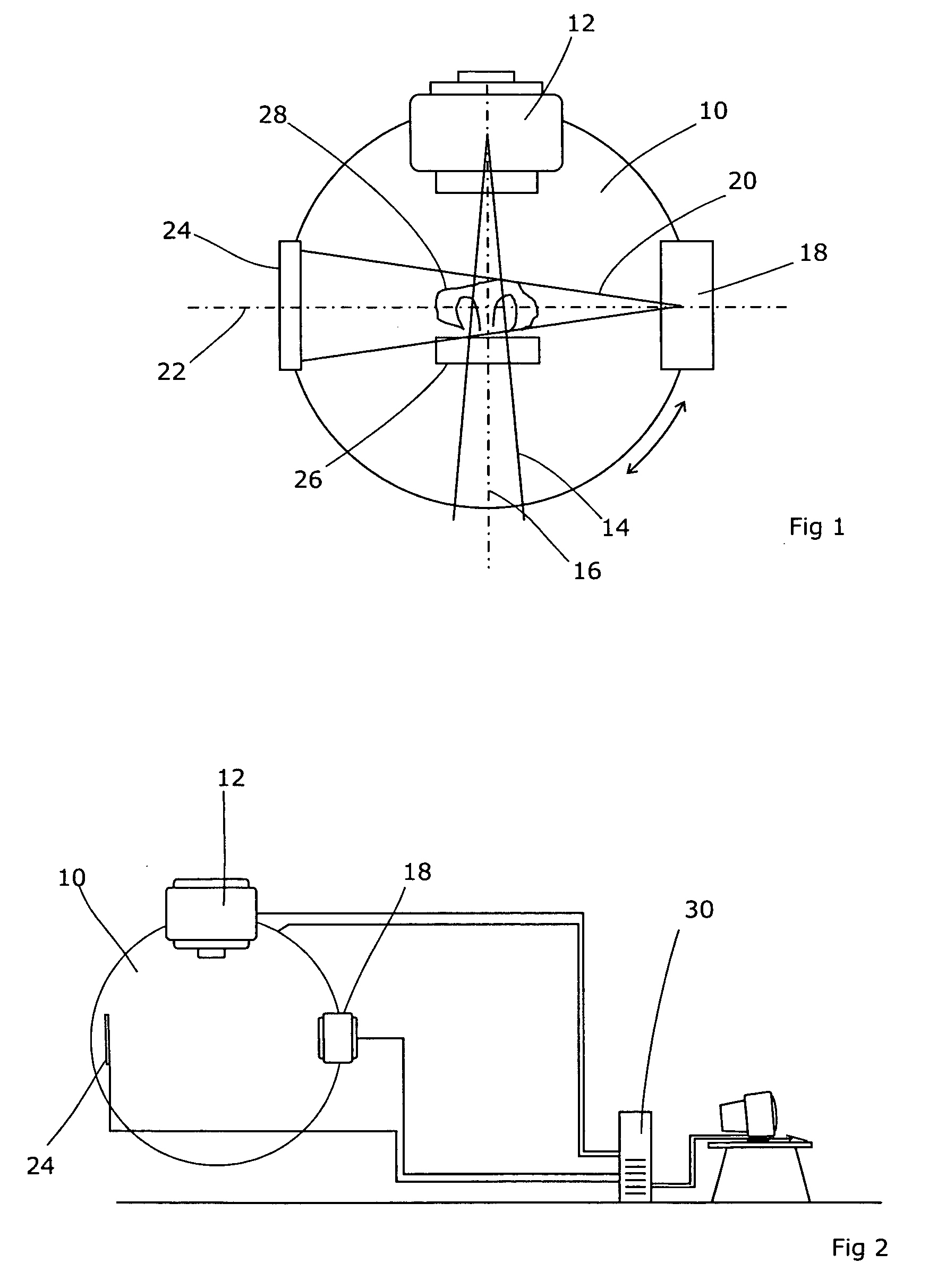 Therapeutic use of radiation and apparatus therefor