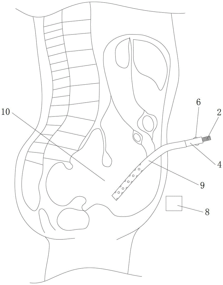 Magnetic field-guided peritoneal dialysis catheter positioning, repositioning, and catheter passing device
