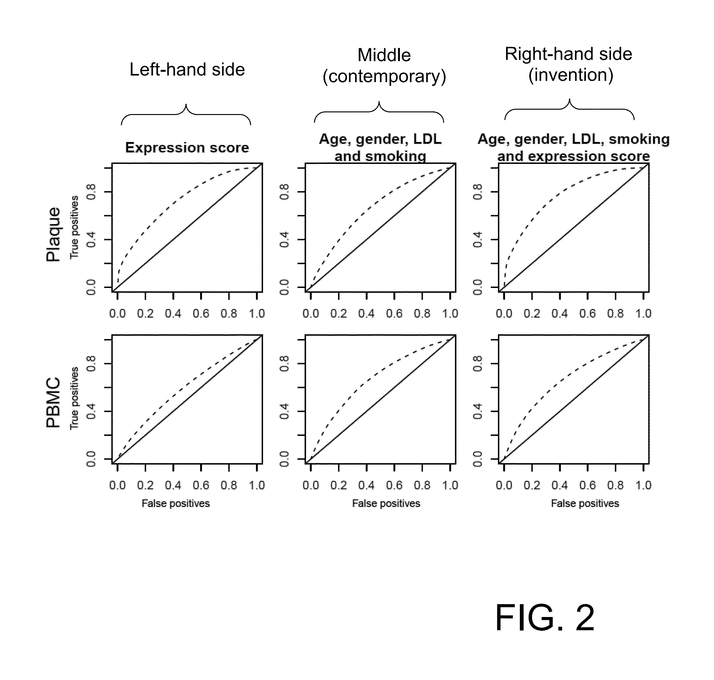 Method and kit for performing profiling of endarterectomy patients