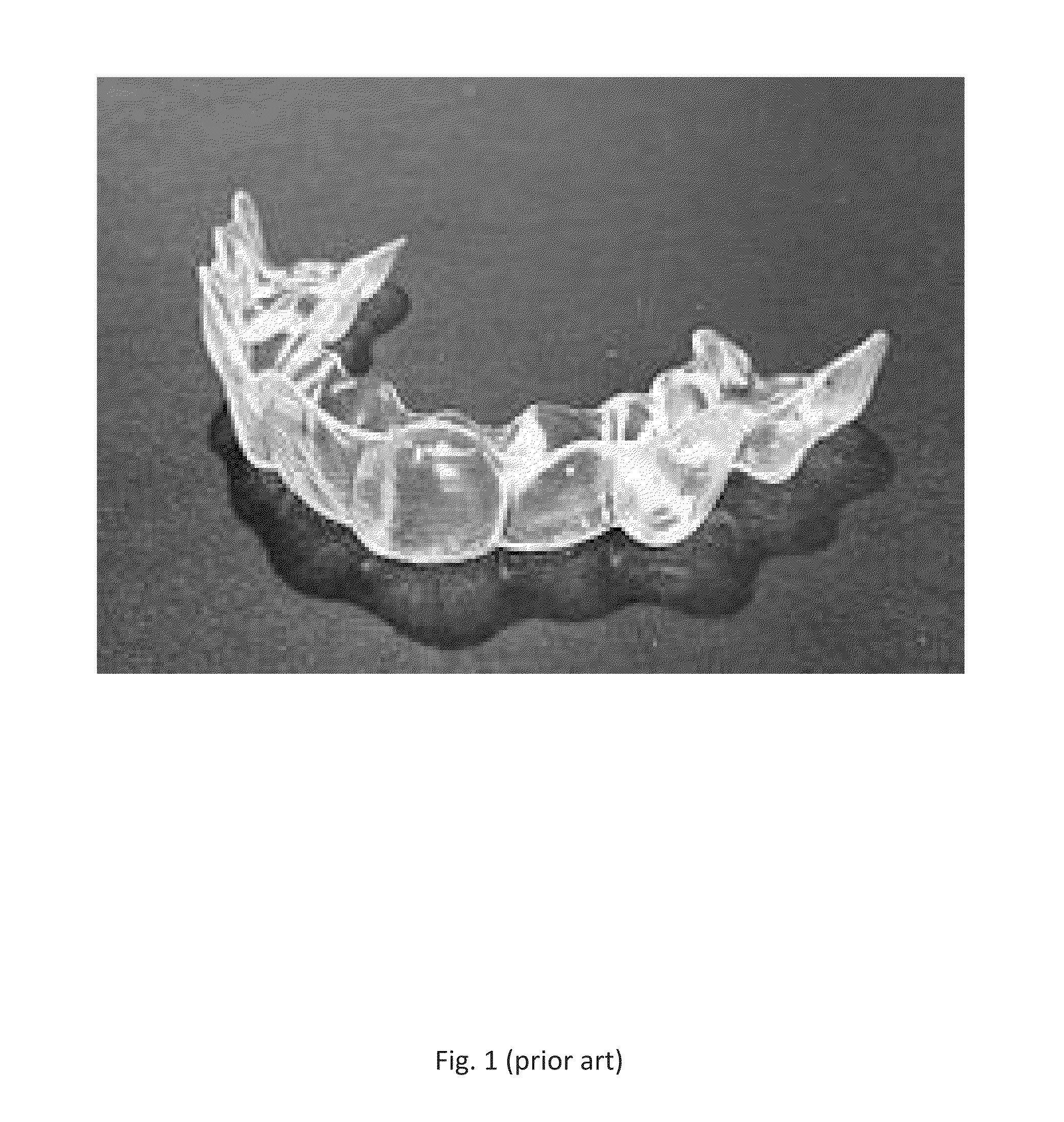 Method for Making and Using Aligners for Orthodontic Treatments