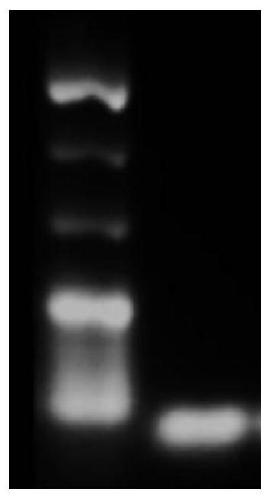 Method for extracting free DNA from human plasma