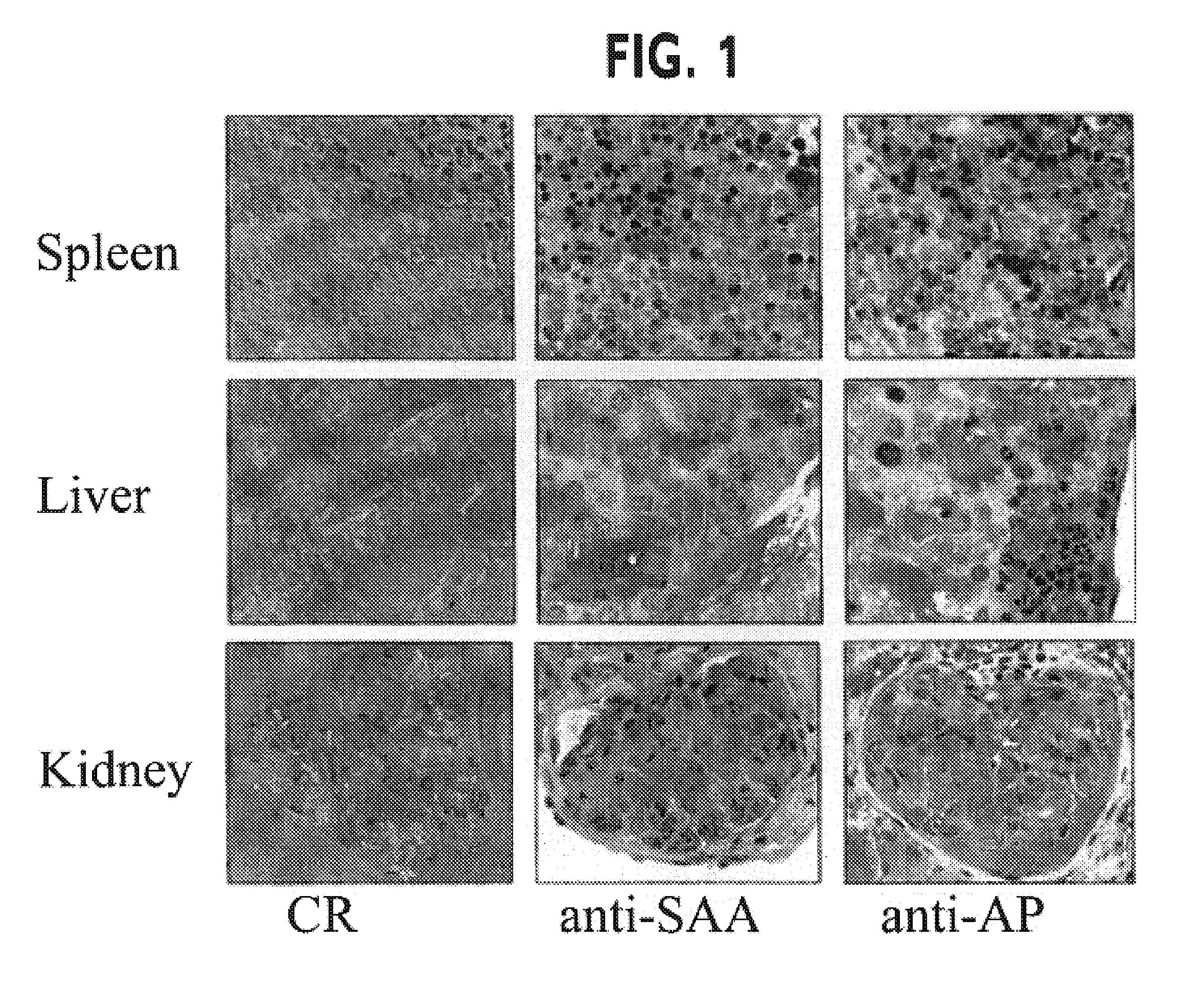 Methods of investigating, diagnosing, and treating amyloidosis