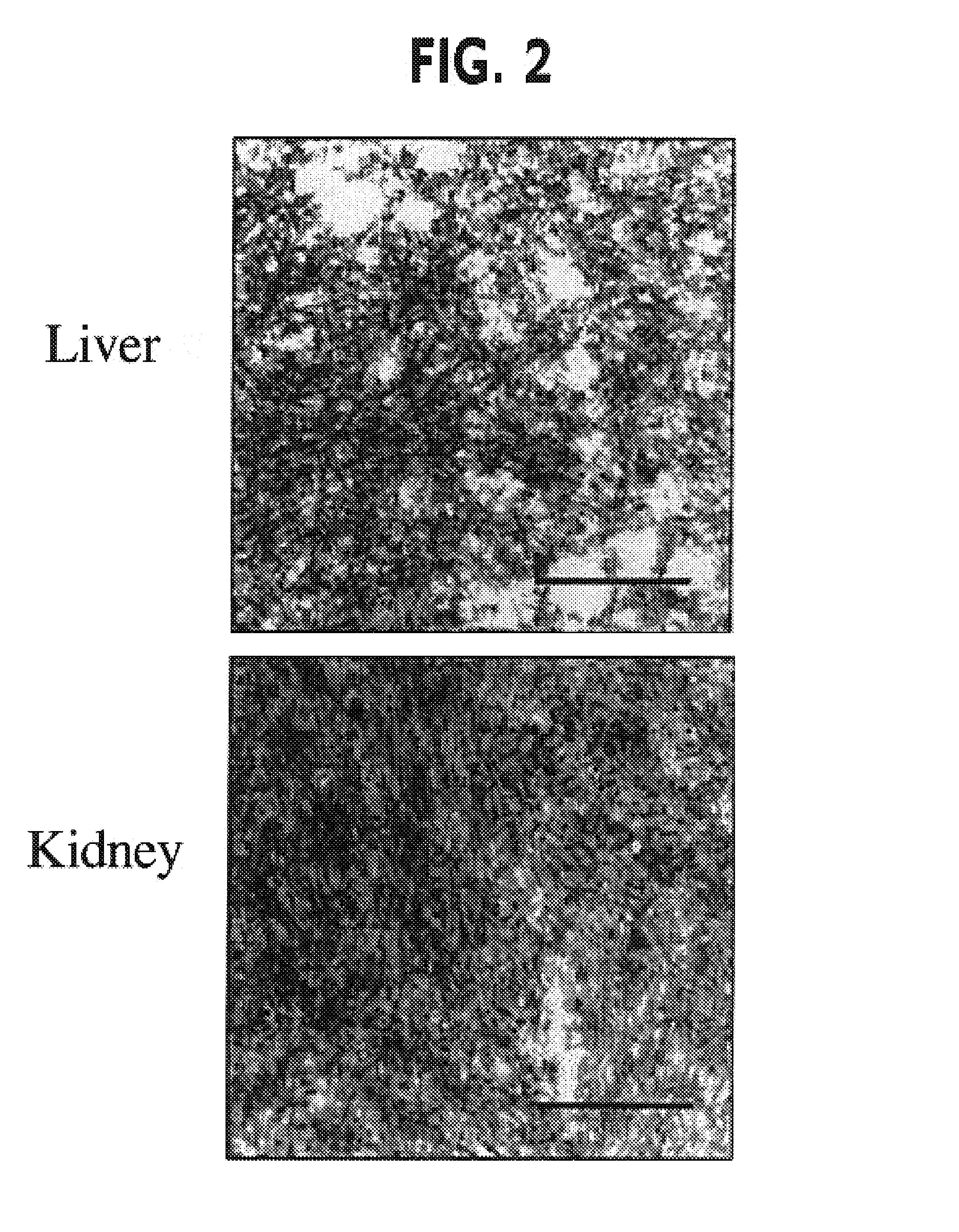 Methods of investigating, diagnosing, and treating amyloidosis