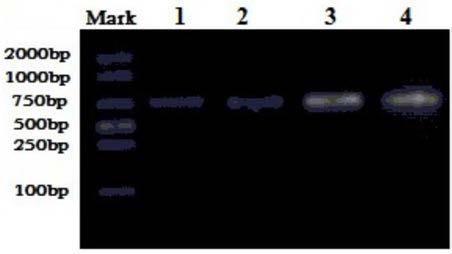 Human tropomyosin receptor kinase A mutant and application