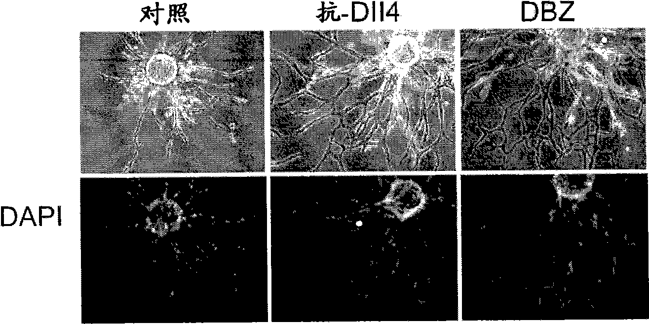 Compositions and methods for modulating vascular development