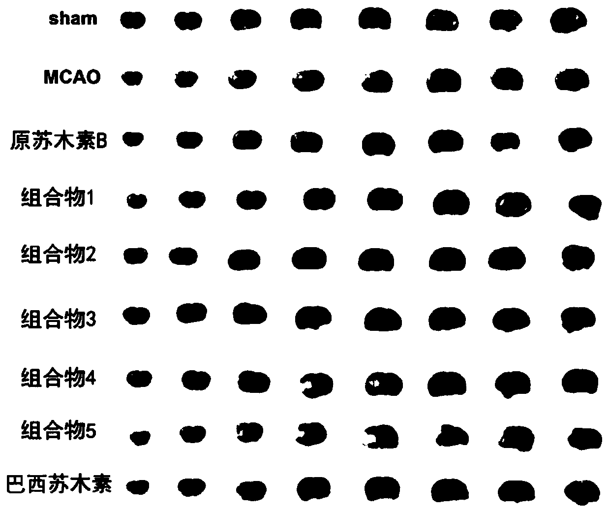 A composition for treating ischemic stroke, its preparation method and medical application