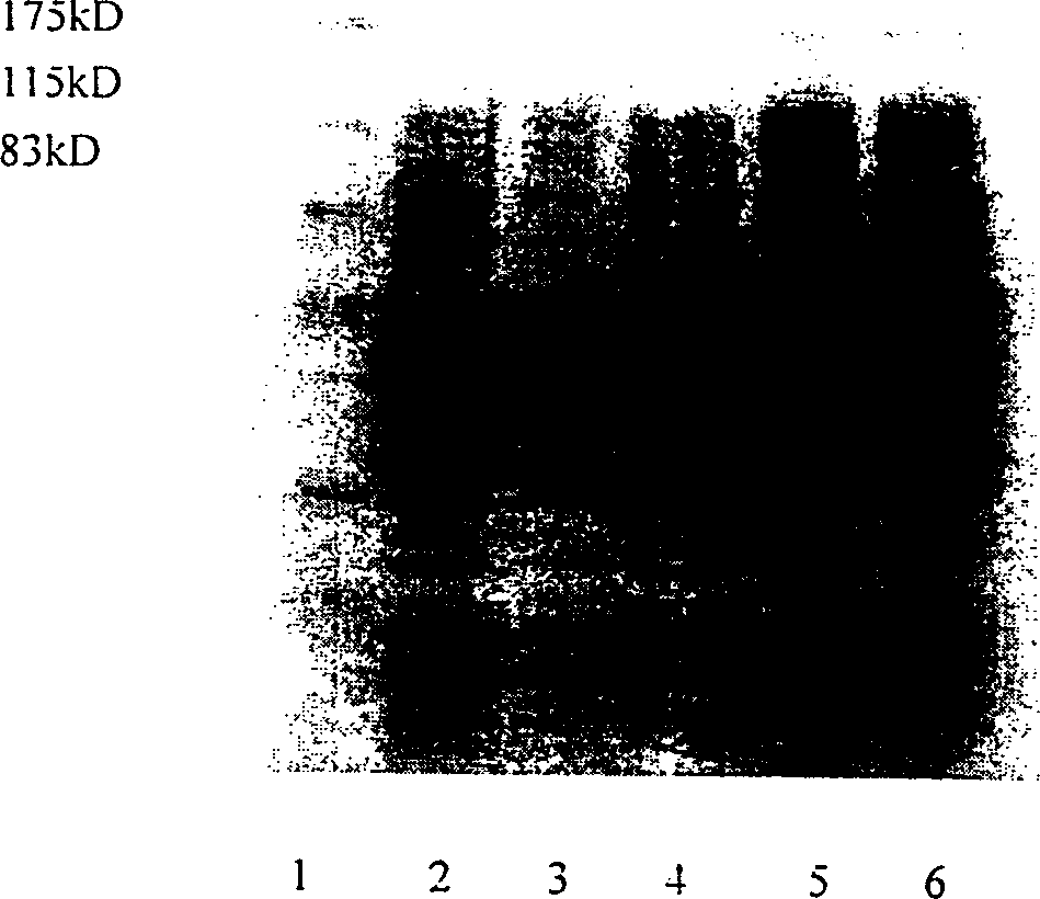 Fusion anticaries DNA vaccine and its preparation