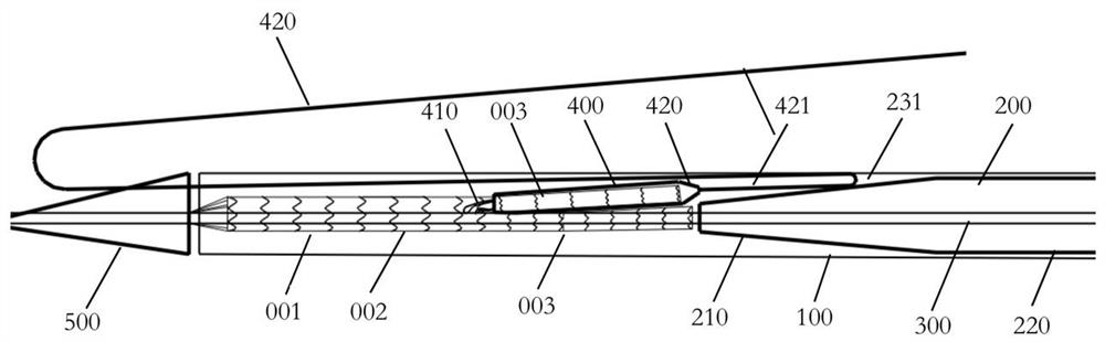 Delivery device and stent system