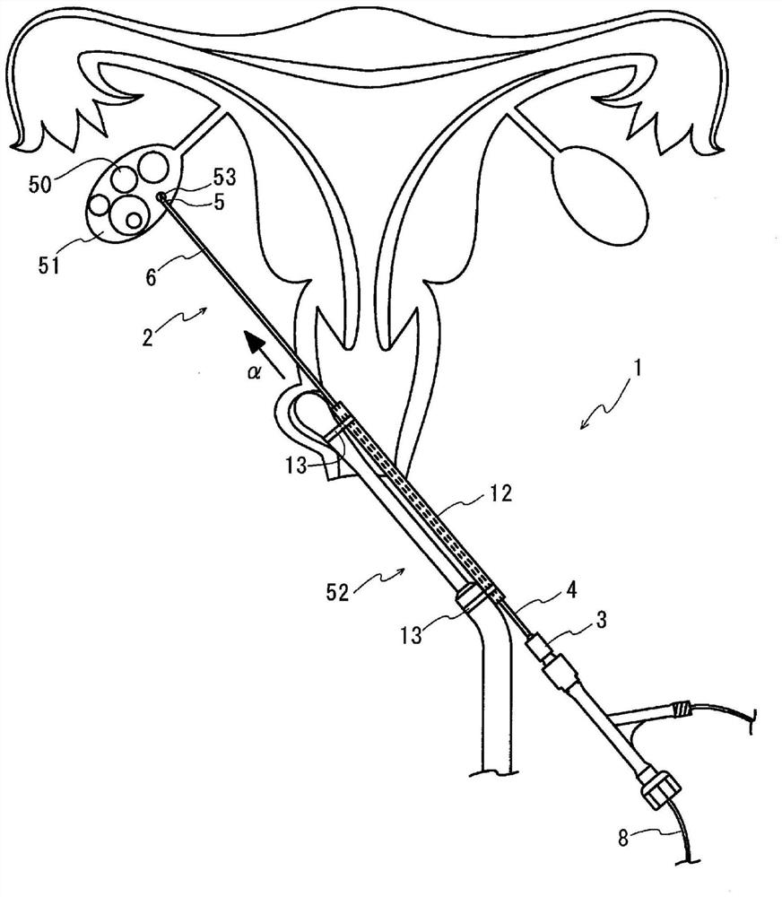 Follicular development inducing apparatus