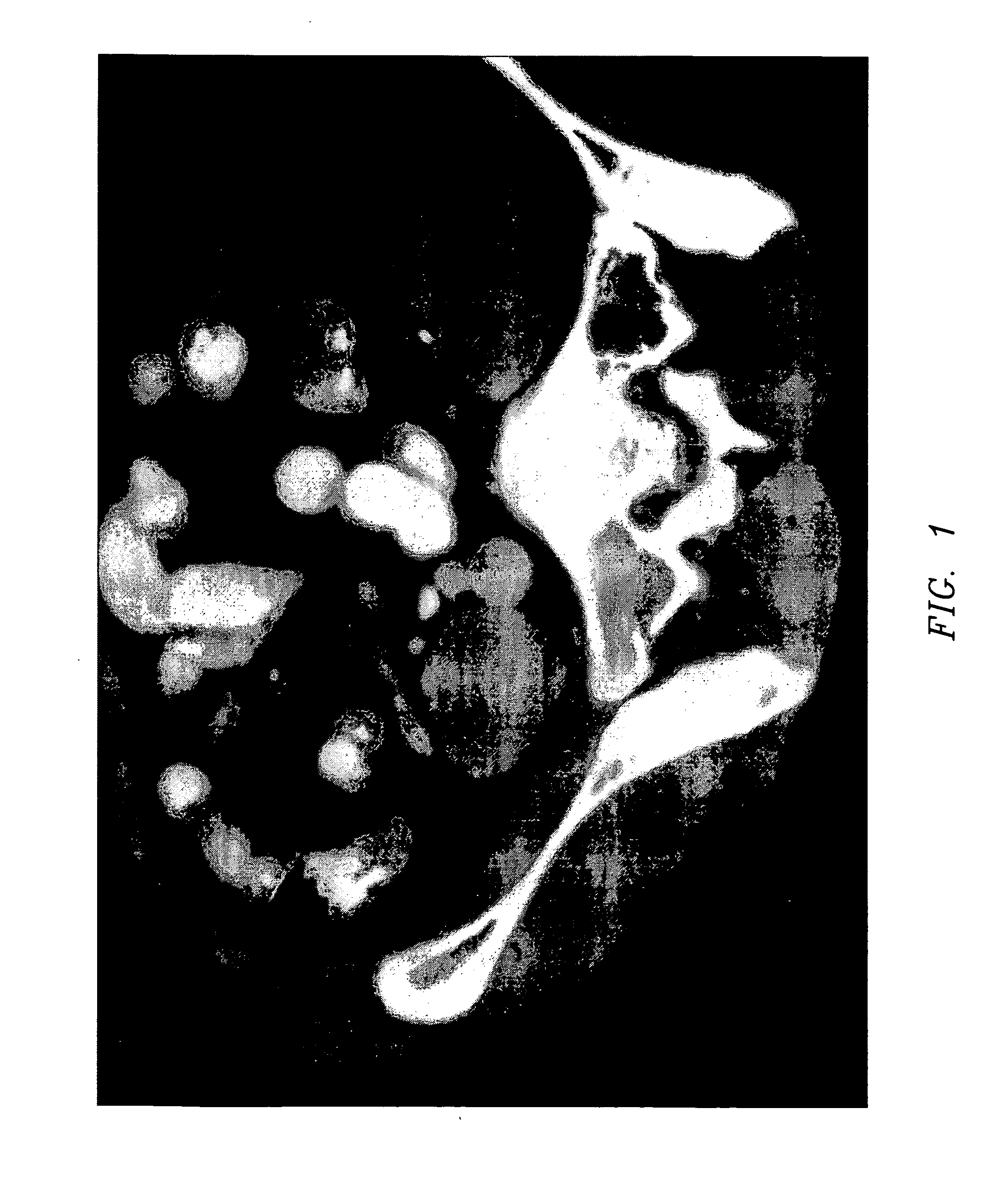 Composition and method for direct visualization of the human appendix
