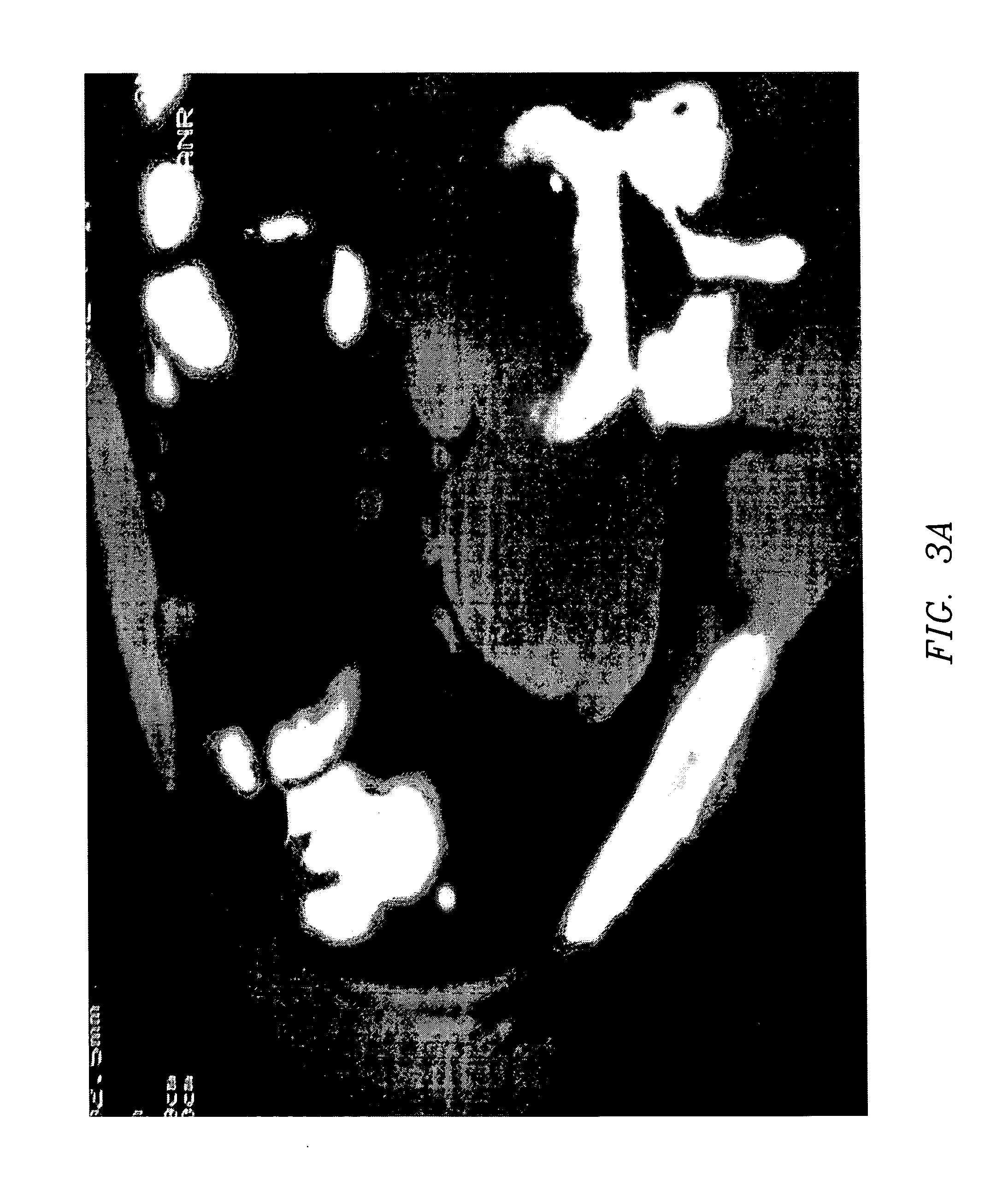 Composition and method for direct visualization of the human appendix