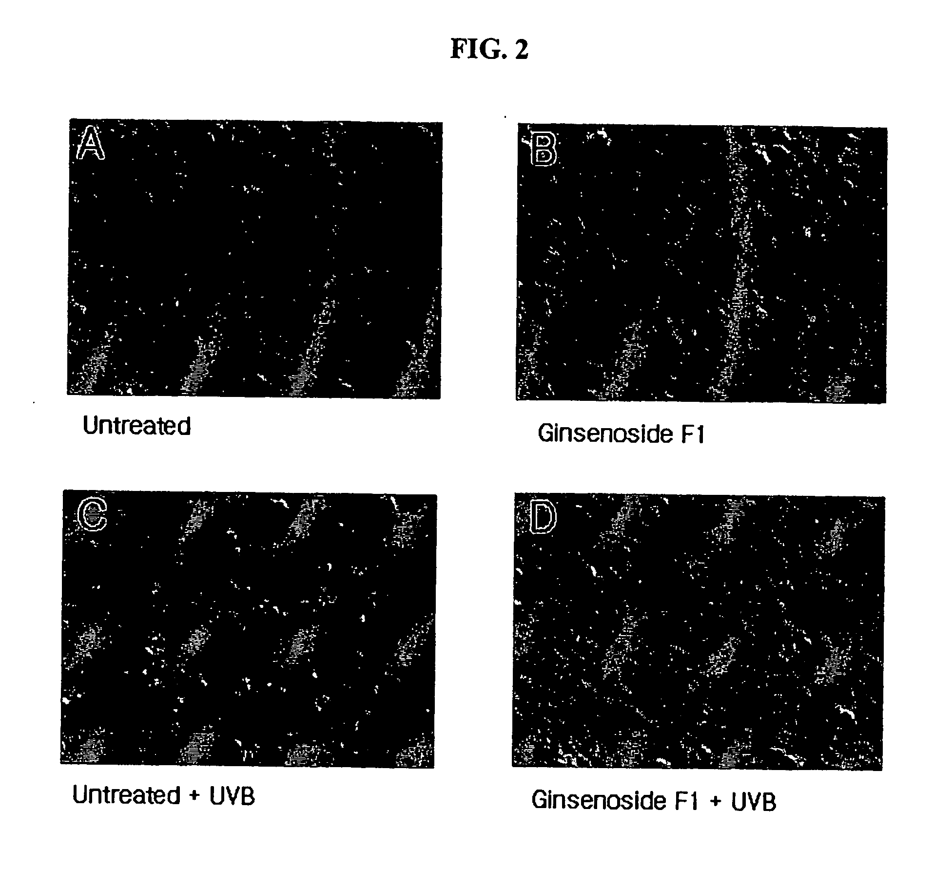 Agent for controlling bcl-2 expression comprising ginsenoside f1 as an active component