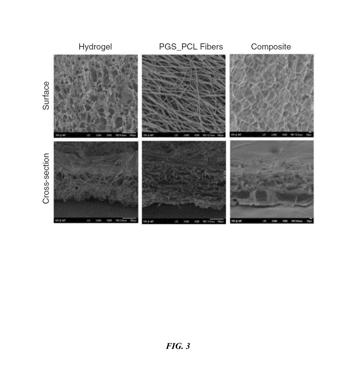 Scaffold for skin tissue engineering and a method of synthesizing thereof