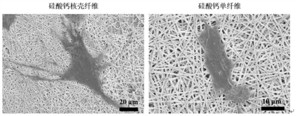 A kind of preparation method of ceramic-based core-shell fiber