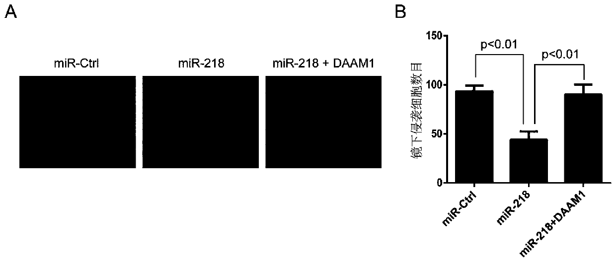 Application of miR-218 in preparing breast cancer chemotherapeutic drug sensitizer