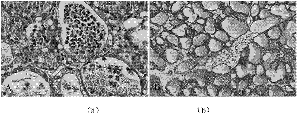 Mouse mammary gland syringe needle and application thereof