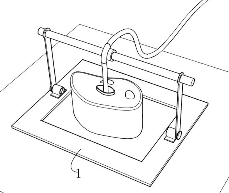 Bridging structure for fixing umbilical vein indwelling catheter of newborn