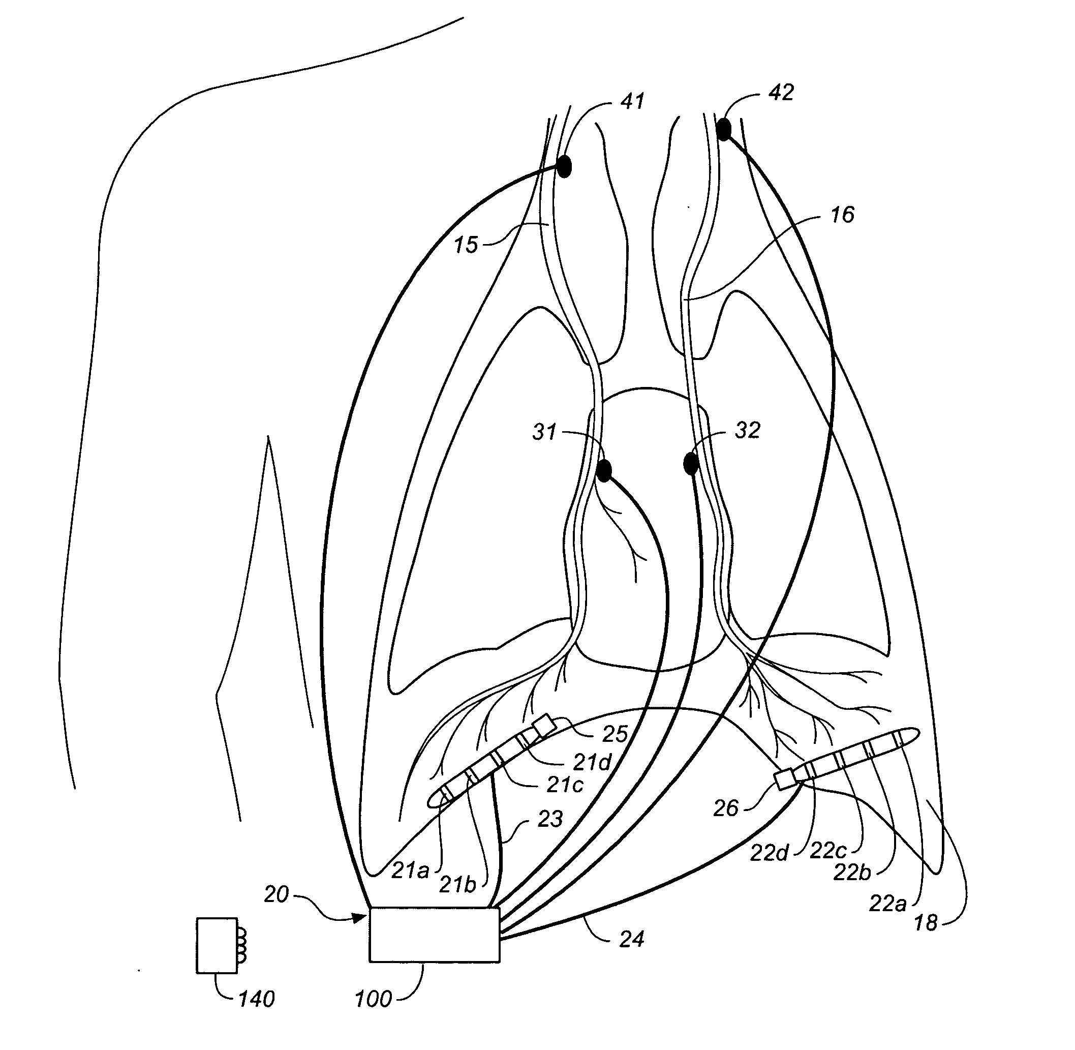 Device and method for controlling breathing