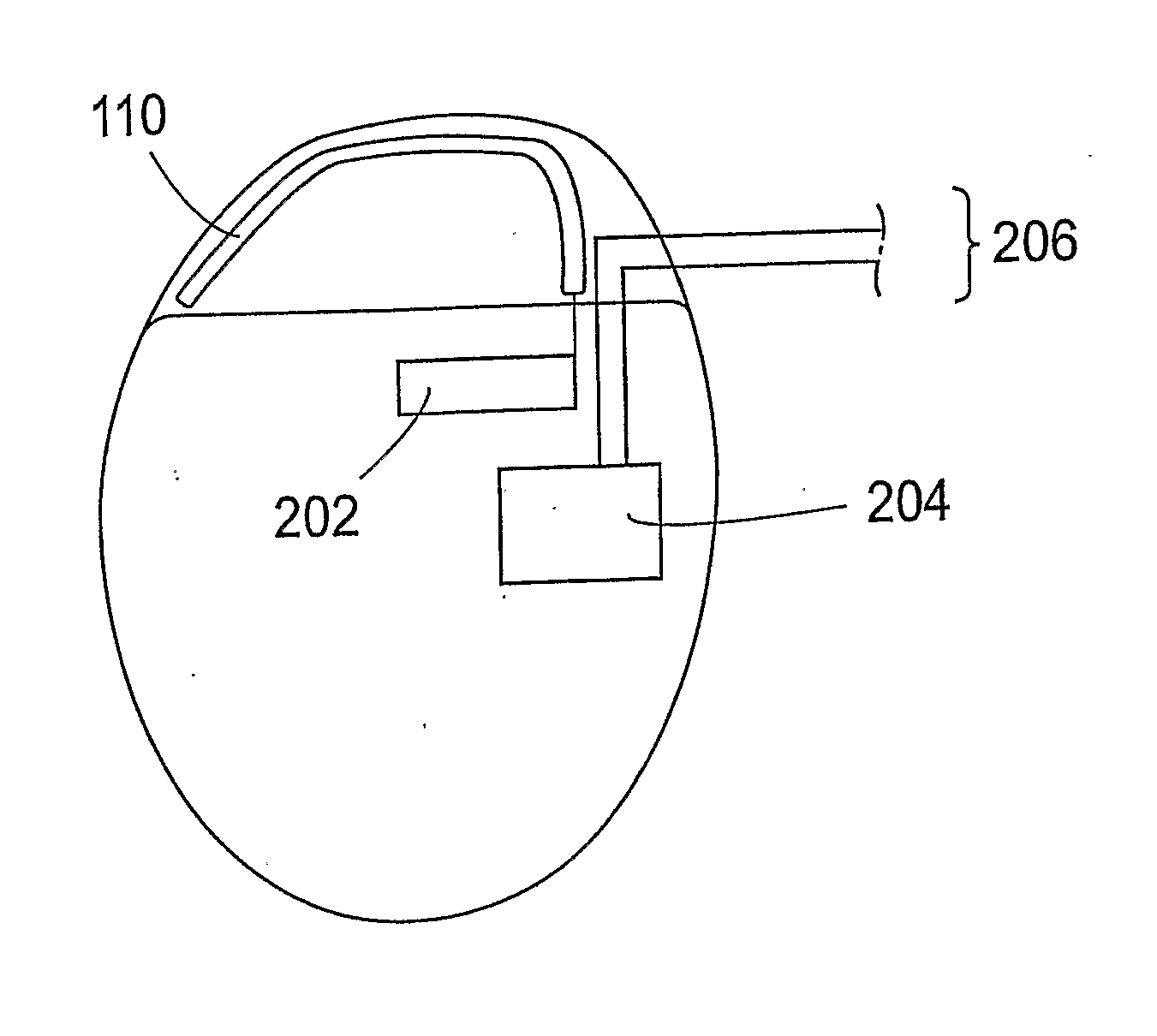 System, an apparatus and a container for storing an implantable medical device, and a method for packaging such a device