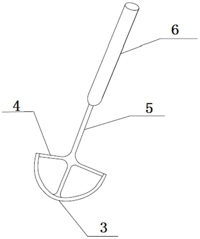 An aortic valve supraplasty fixation device
