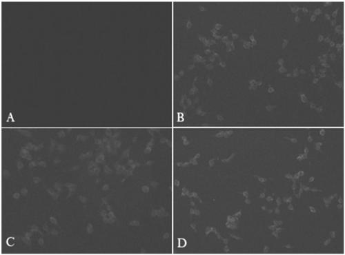 Construction and application of Xinjiang hemorrhagic fever virus multi-epitope eukaryotic expression vector pVAX-MEPX2