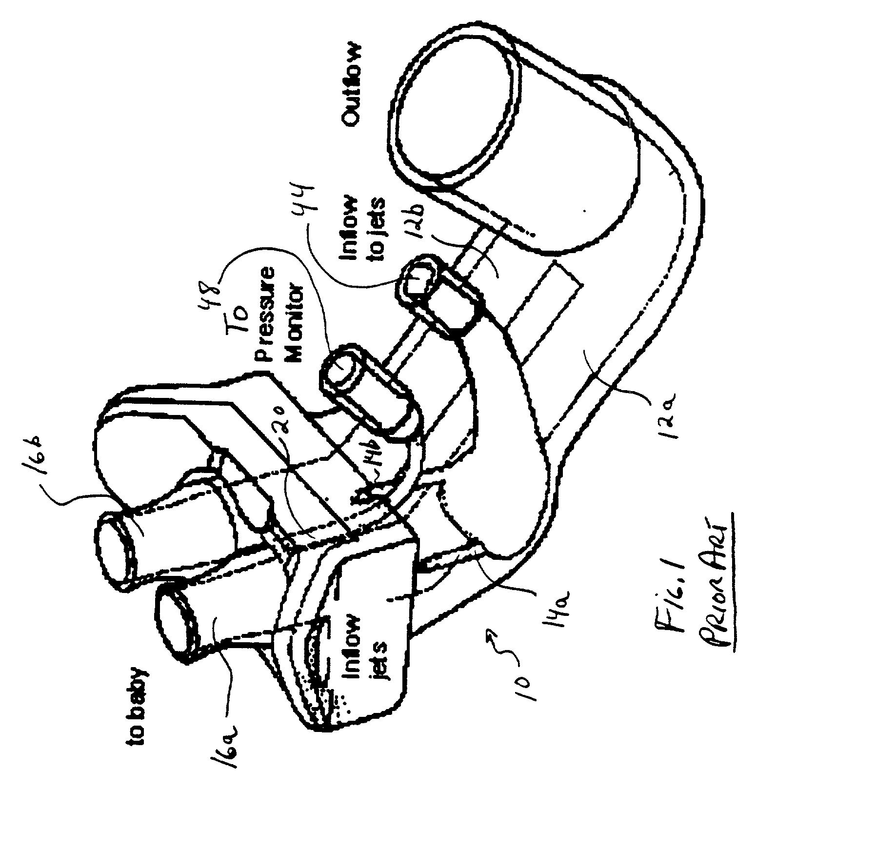 Method and apparatus for injecting sighs during the administration of continuous positive airway pressure therapy