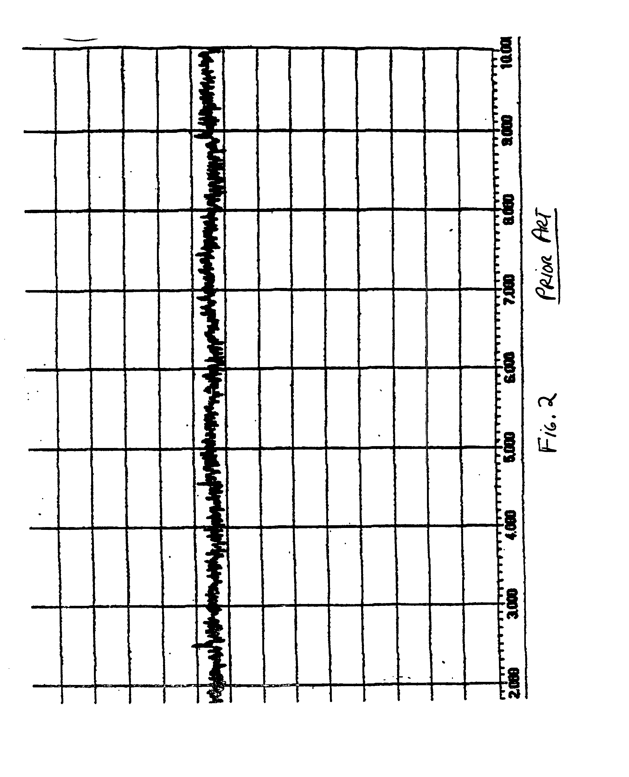 Method and apparatus for injecting sighs during the administration of continuous positive airway pressure therapy