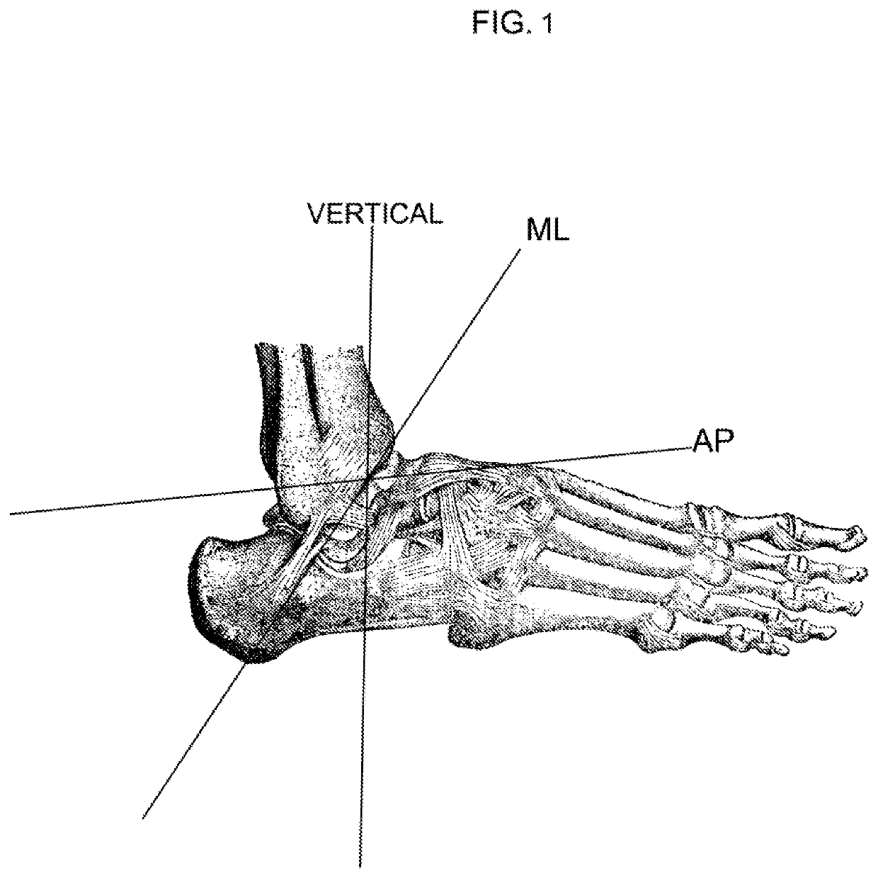 Ankle orthosis