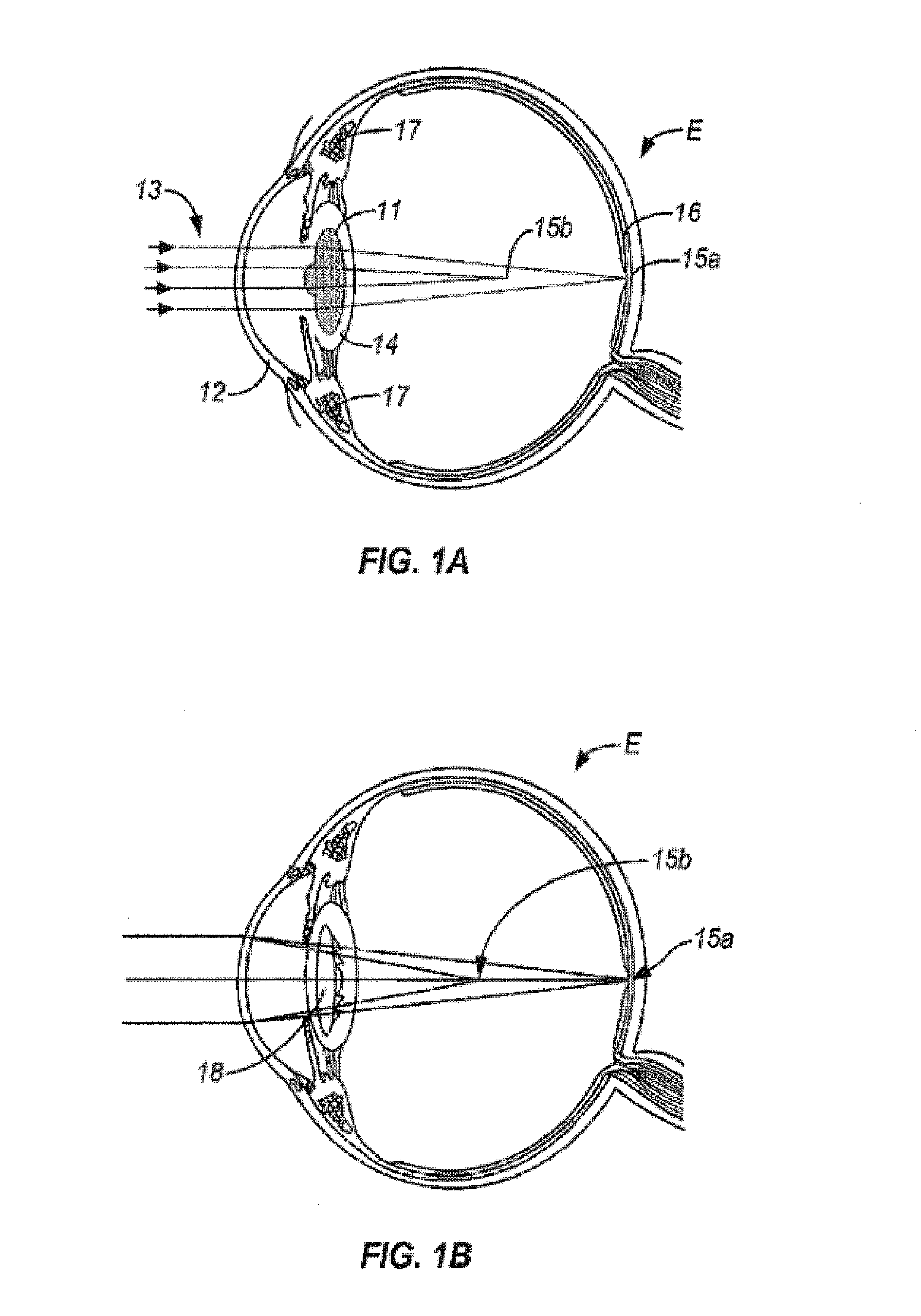 Multi-ring lens, systems and methods for extended depth of focus
