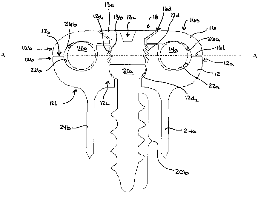 Non-fusion spinal correction systems and methods