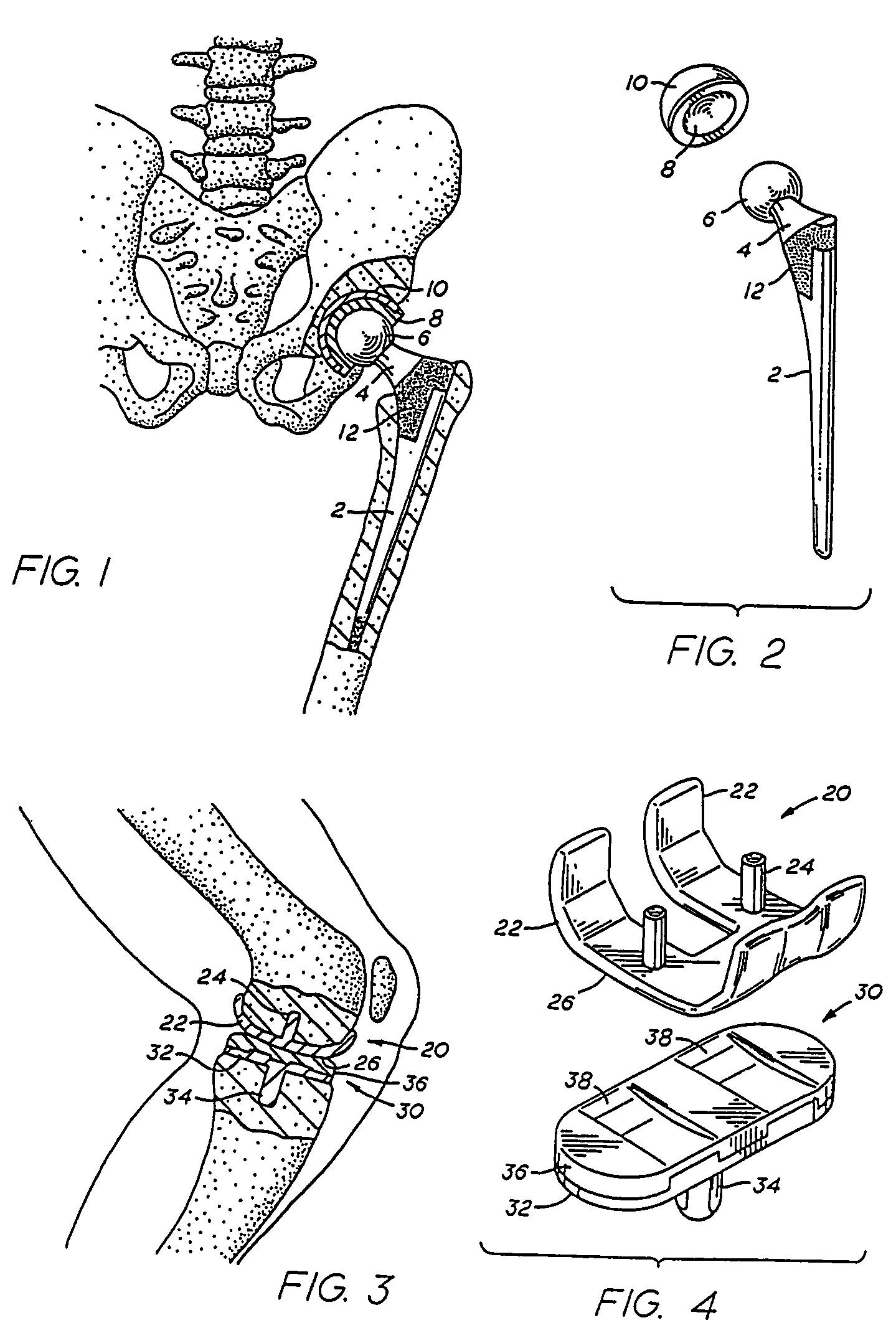 Method of surface oxidizing zirconium and zirconium alloys and resulting product