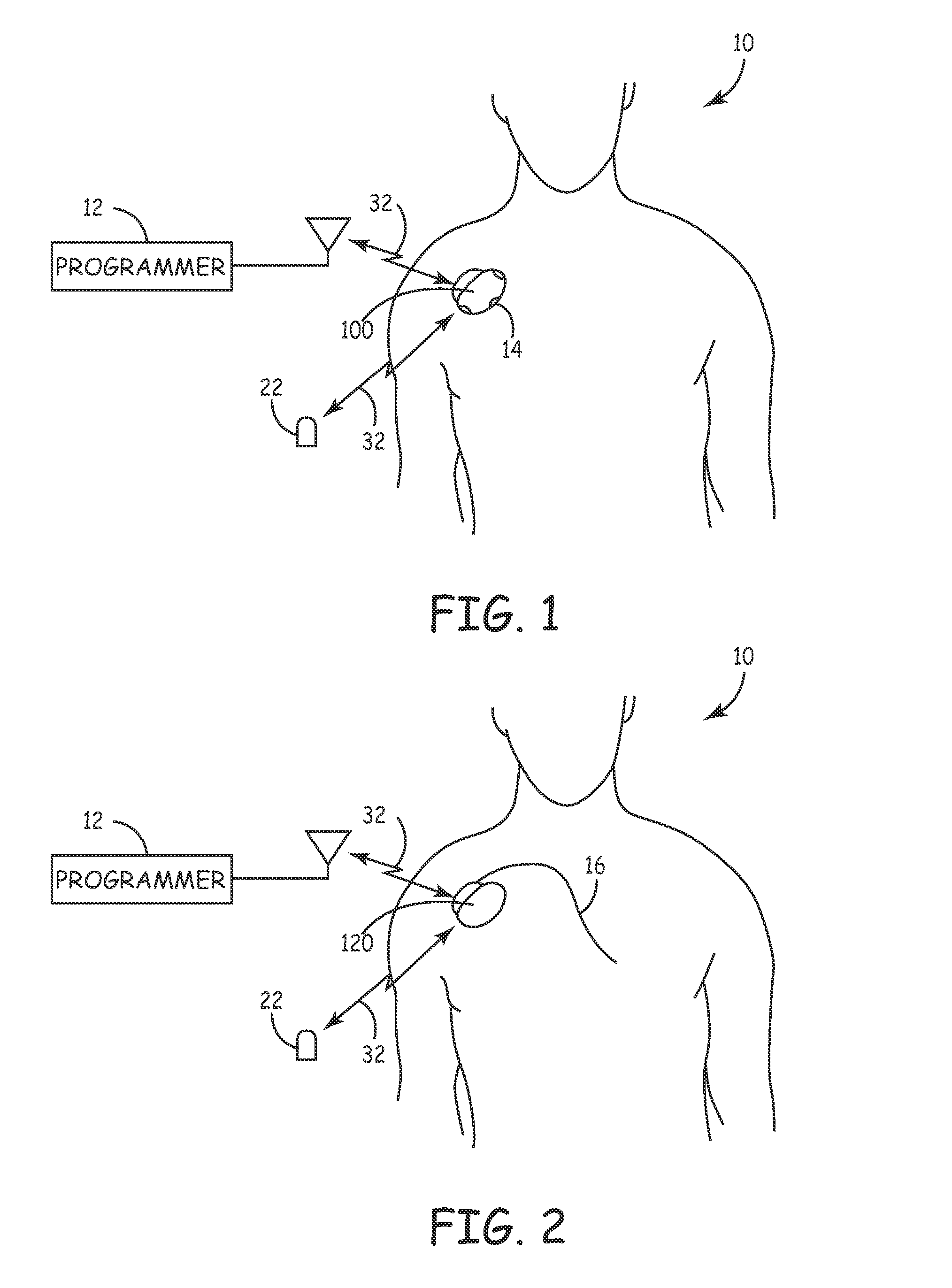 System and method for regulating cardiopulmonary triggered therapy to the brain