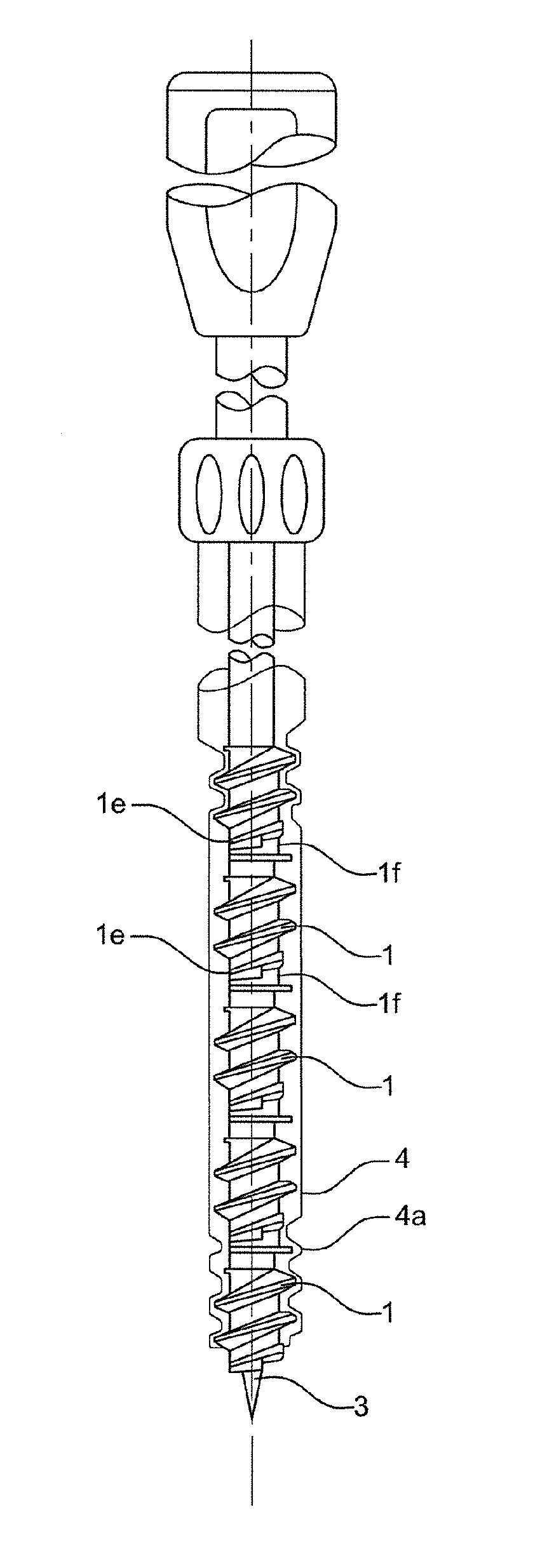 Device comprising a plurality of implants for the fixing of prosthetic material