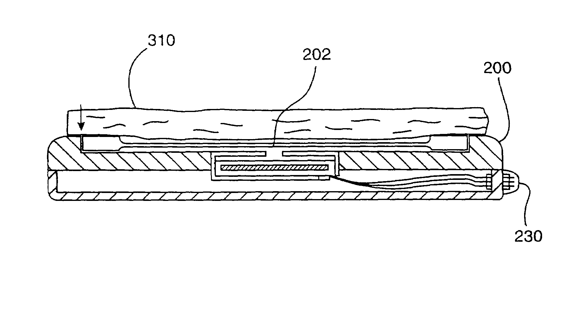 Implantable microphone having sensitivity and frequency response