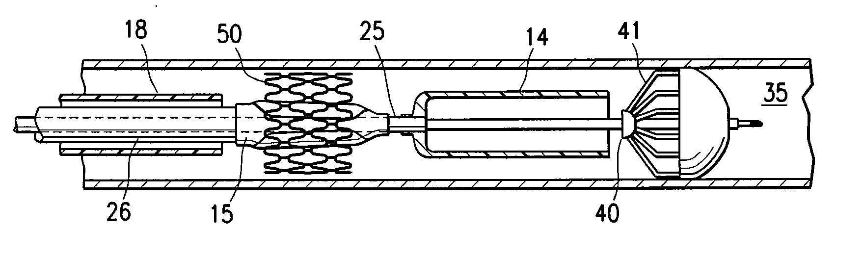 Highly trackable balloon catheter system and method for collapsing an expanded medical device