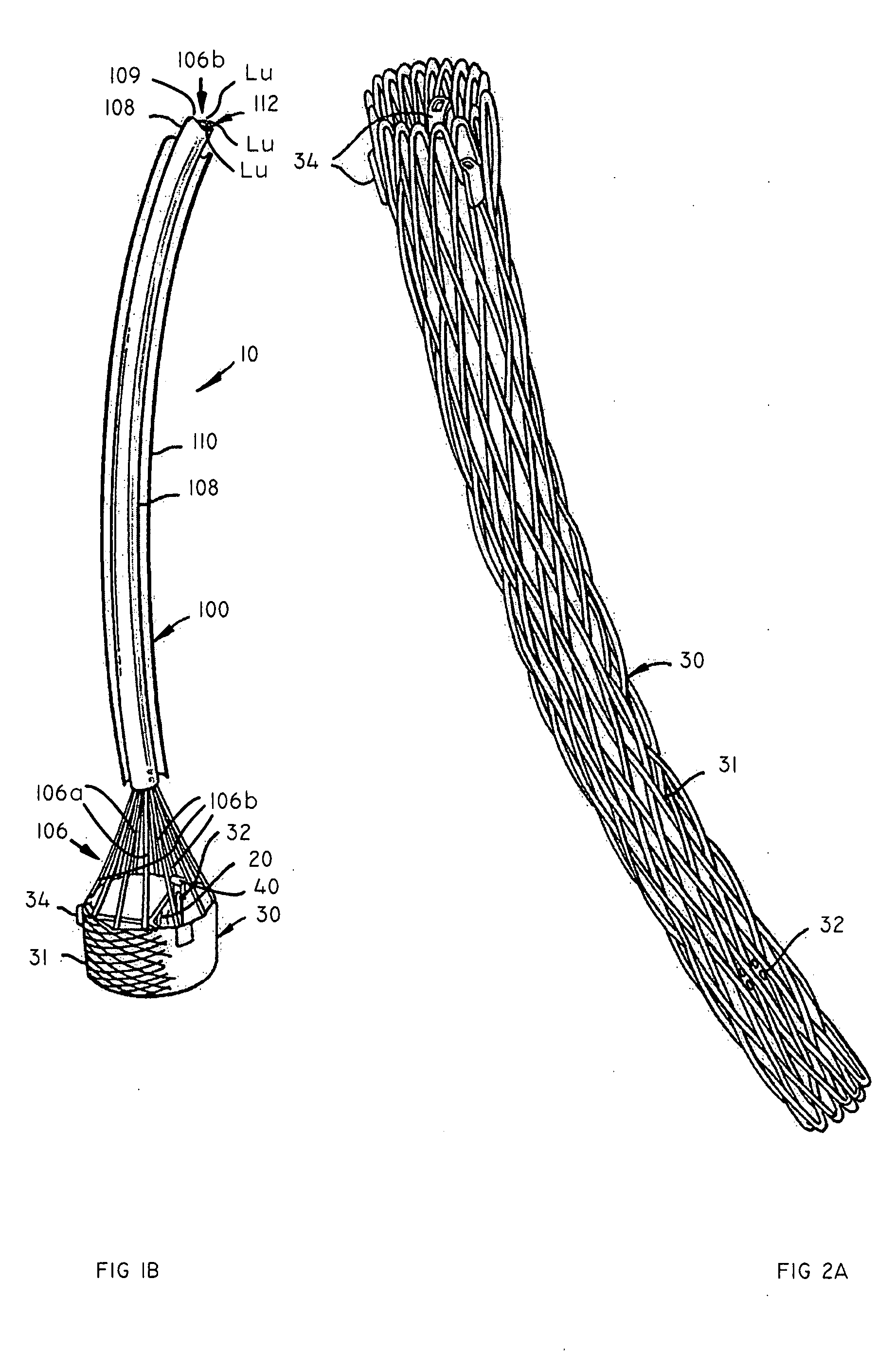 Systems and methods for delivering a medical implant