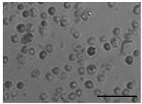 Preparation method and kit to prepare hematogenous female autologous germline stem cells and application of kit