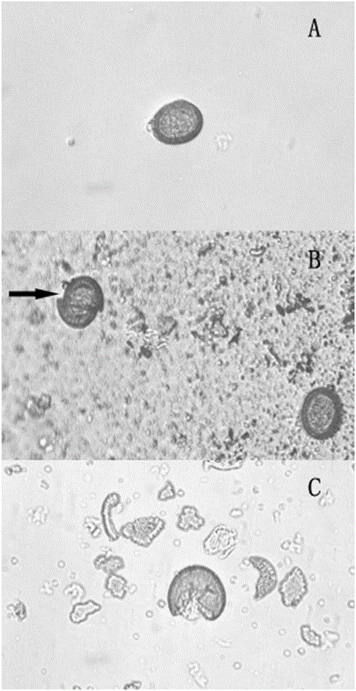 Method for detecting Echinococcus multilocularis from fox excrement
