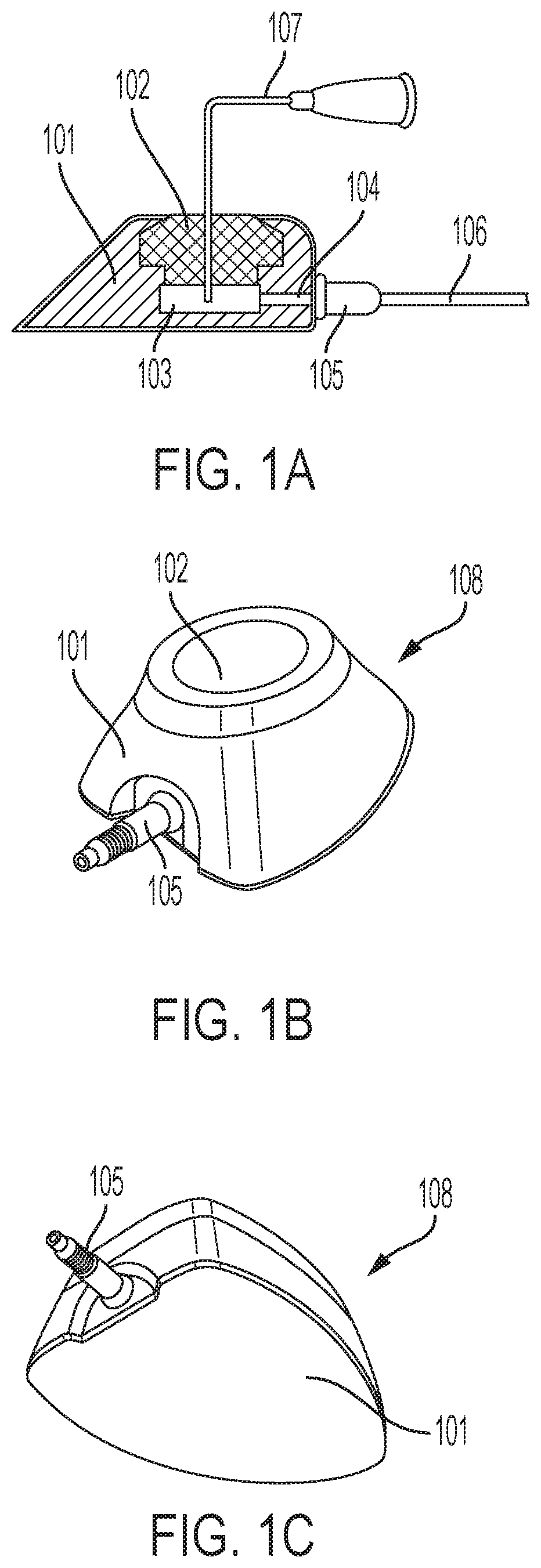 Access port system with self-adjusting catheter length