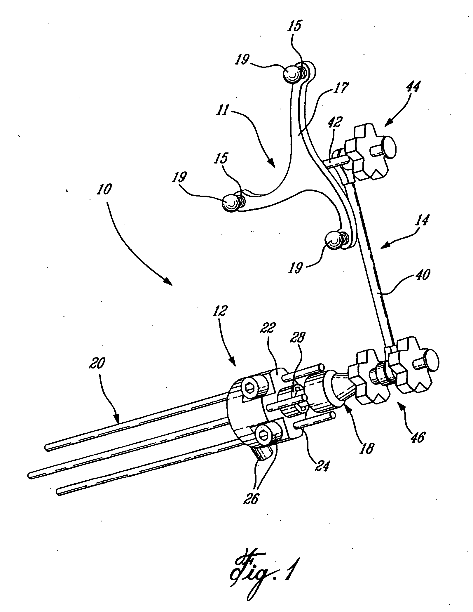 CAS modular body reference and limb position measurement system
