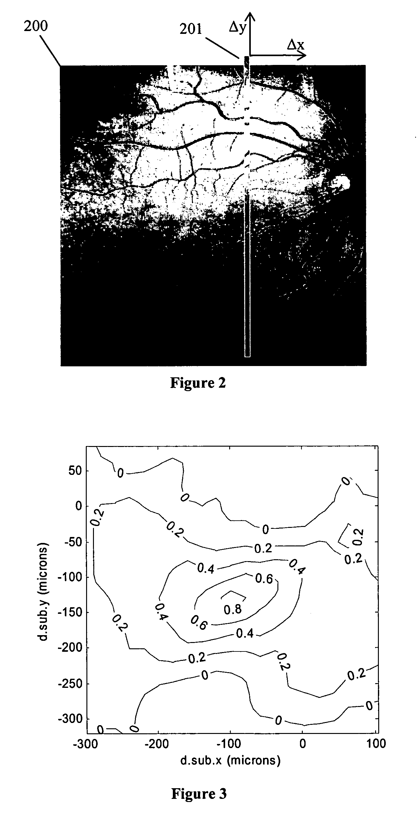 Method and apparatus for measuring motion of a subject using a series of partial images from an imaging system